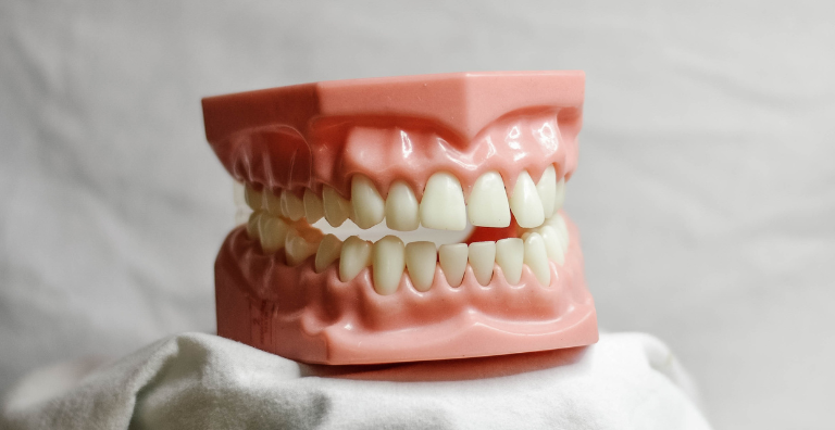 Ein Gebiss als Muster. Strahlend weiße Zähne