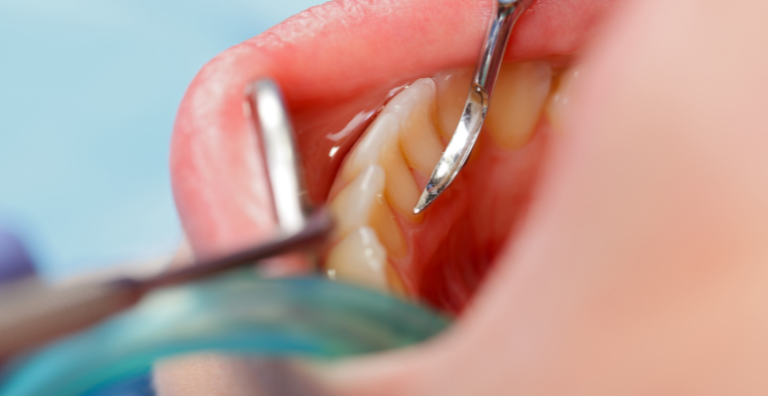 Zahnärztin kontrolliert Zähne einer Patientin.